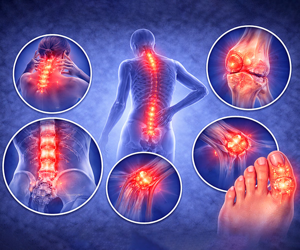 Doenças-Osteoarticulares